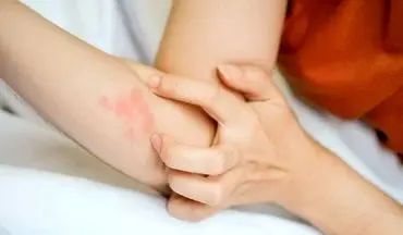 مصرف ماهی موجب کاهش التهابات در بدن کودک !