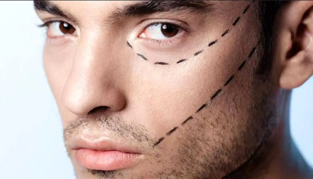  افزایش جراحی‌های زیبایی در میان مردان ایرانی: از کاشت مژه تا لیفت گردن