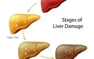 رژیم غذایی در سیروز کبدی پیشرفته !