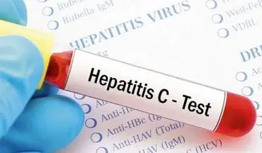 امکان تشخیص و درمان هپاتیت C در یک روز با سریع‌ترین آزمایش جهان