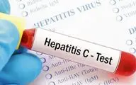 امکان تشخیص و درمان هپاتیت C در یک روز با سریع‌ترین آزمایش جهان