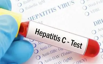 امکان تشخیص و درمان هپاتیت C در یک روز با سریع‌ترین آزمایش جهان