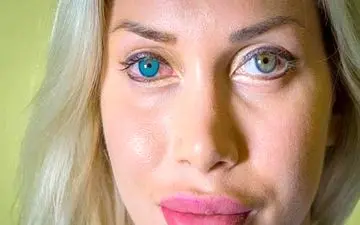 عمل زیبایی عجیب و باورنکردنی خانم مانکن مشهور + عکس ها