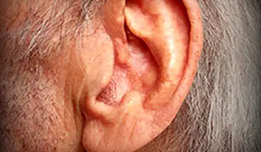 استفاده از تکنولوژی جدید برای مقابله با کم شنوایی
