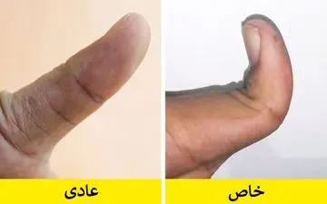 حقایق عجیب و غریب بدن انسان که فقط در عده کمی دیده می شود!