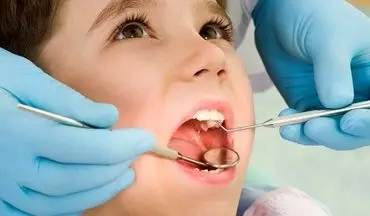 عوارض عدم آشنایی دندانپزشک با کاربرد لیزر/ سوختگی لثه