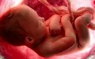 دلیل زیاد شدن زایمان زودرس، سقط جنین و مرگ نوزادان شیرخوار