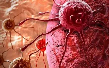 بروز «سرطان» در ایران بسیار کمتر از متوسط جهانی است