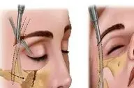 شکستگی‌های صورت تنها ظاهر فرد را تغییر نمی‌دهند، بلکه این بلاها را سر تنفس، بینایی، تکلم، بلع می آورد