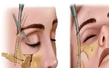 شکستگی‌های صورت تنها ظاهر فرد را تغییر نمی‌دهند، بلکه این بلاها را سر تنفس، بینایی، تکلم، بلع می آورد