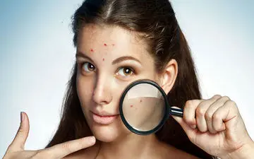 وقتی جوش زدن باعث خوشحالی شما می شود