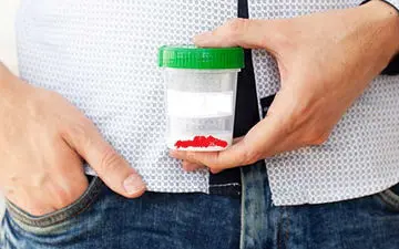 علائم وجود خون در مایع منی