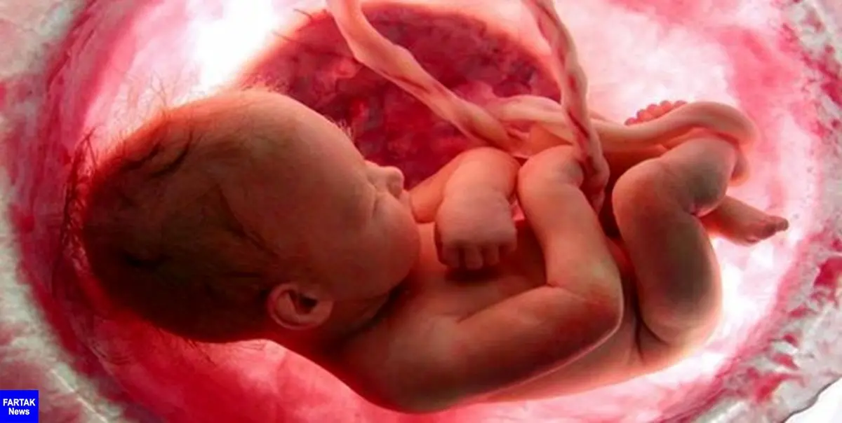 کرونا خطر سقط جنین را افزایش نمی‌دهد