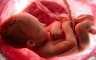 کرونا خطر سقط جنین را افزایش نمی‌دهد