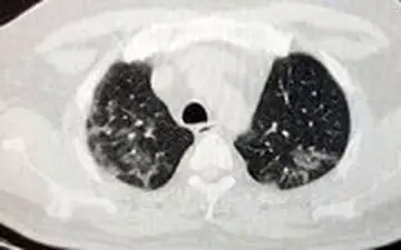 پست غم انگیز و هشدار دهنده درباره عواقب عدم رعایت پروتکل‌ها و ماسک نزدن