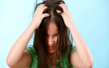 درمان خارش سر! 