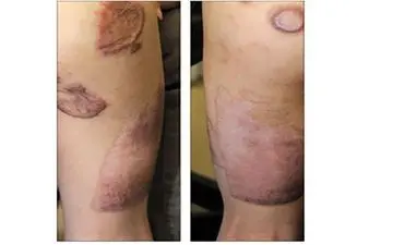 آزار هولناک نوید کوچولو توسط ناپدری اش در حمام +عکس 14+