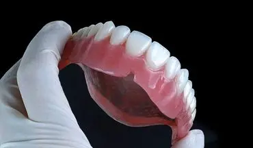 آیا دندان مصنوعی تاریخ مصرف دارد ؟ / هر آنچه که باید از نحوه نگهداری دندان مصنوعی بدانید
