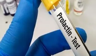 زنان پیش از بارداری این آزمایش را حتما بدهند