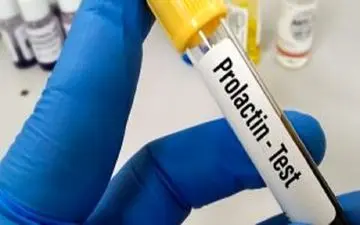 زنان پیش از بارداری این آزمایش را حتما بدهند