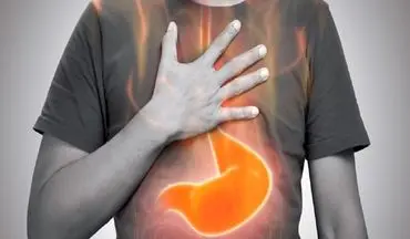 اثر ریفلاکس معده بر بروز اختلالات خواب