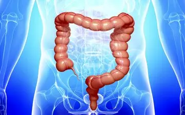 میکروب های روده عامل بروز سندروم خستگی مزمن