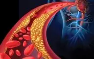 تغذیه‌ در بیماران مبتلا به اختلال چربی خون