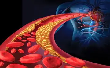 تغذیه‌ در بیماران مبتلا به اختلال چربی خون