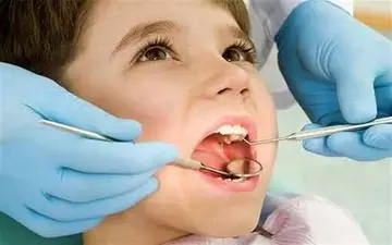 "قطره آهن" باعث پوسیدگی دندان‌ کودکان می‌شود؟