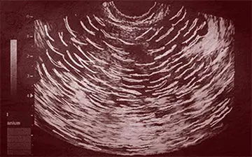 راهپیمایی آلمانی‌ها در اعتراض به عمل سقط جنین + فیلم 