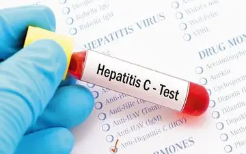 راه های انتقال هپاتیت C

