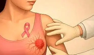 مراقب باشید| سرطان سینه را اینگونه کنترل کنید!