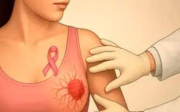 مراقب باشید| سرطان سینه را اینگونه کنترل کنید!