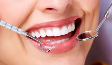  مهمترین علل شکستگی و لق شدن دندان‌ها