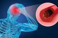 علائم غلظت خون چیست؟ |ارتباط بین غلظت خون و سابقه بیماری‌ها
