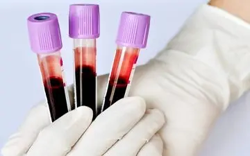 در مورد کم خونی فقر آهن بیشتر بدانید!