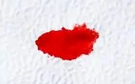 درمان خونریزی بعد از رابطه جنسی!