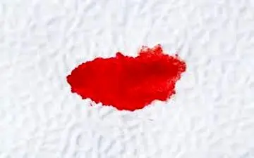 درمان خونریزی بعد از رابطه جنسی!