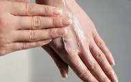 چگونه خشکی پوست را درمان کنیم؟

