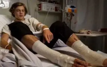 موجودات اسرارآمیز گوشت پاهای این پسر را خوردند (+18 عکس)