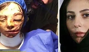 چهره وحشتناک بازیگر زن ایرانی + عکس