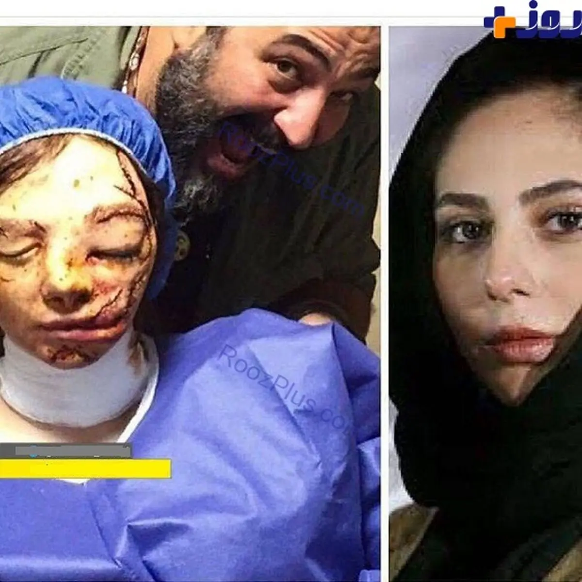 چهره وحشتناک بازیگر زن ایرانی + عکس