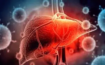 ۴ دلیل که شما را گرفتار کبدچرب می‌کند