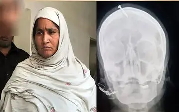  اقدام جنون آمیز یک رمال/ فرو کردن میخ بر سر زن دخترزا