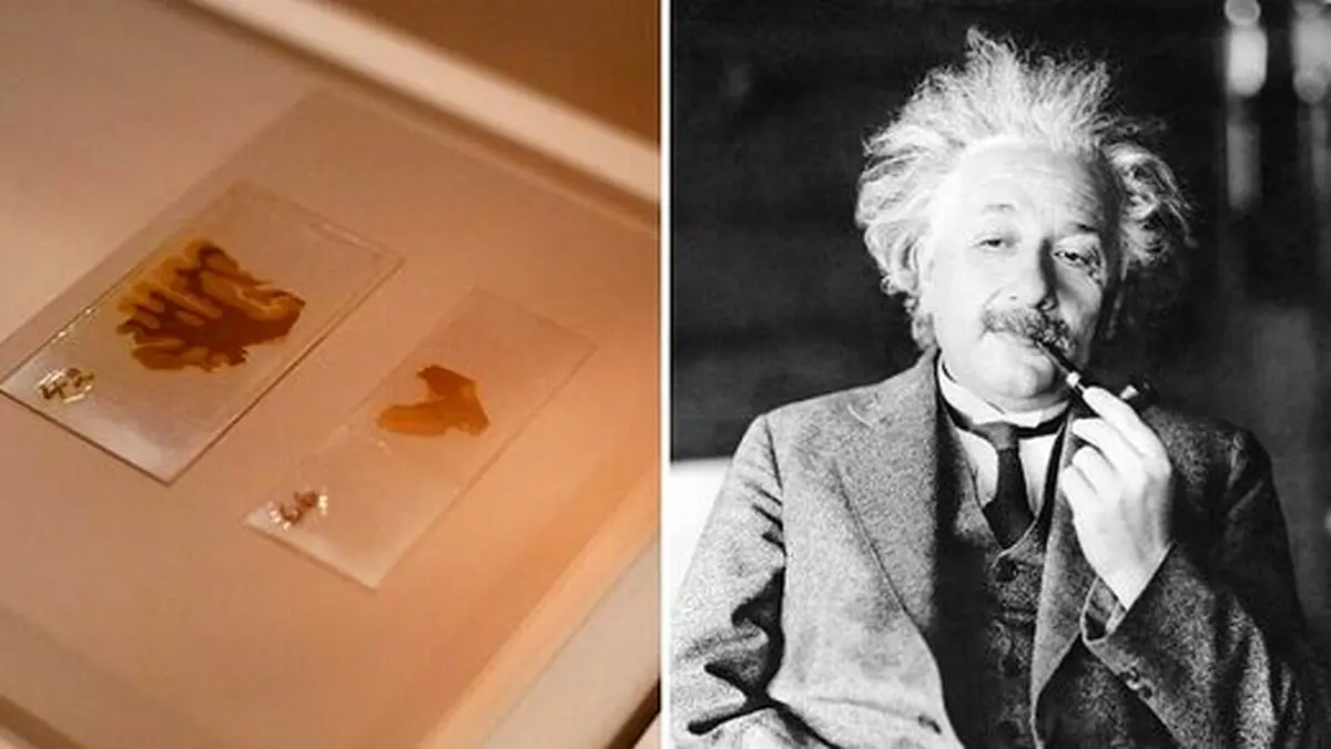این بلا پس از مرگ بر سر مغز اینشتین آمد!