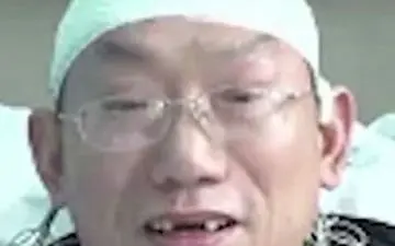 بی دندان شدن جراح چینی در نتیجه خستگی زیاد