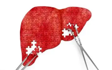 درمان دارویی و گیاهی کبد چرب
