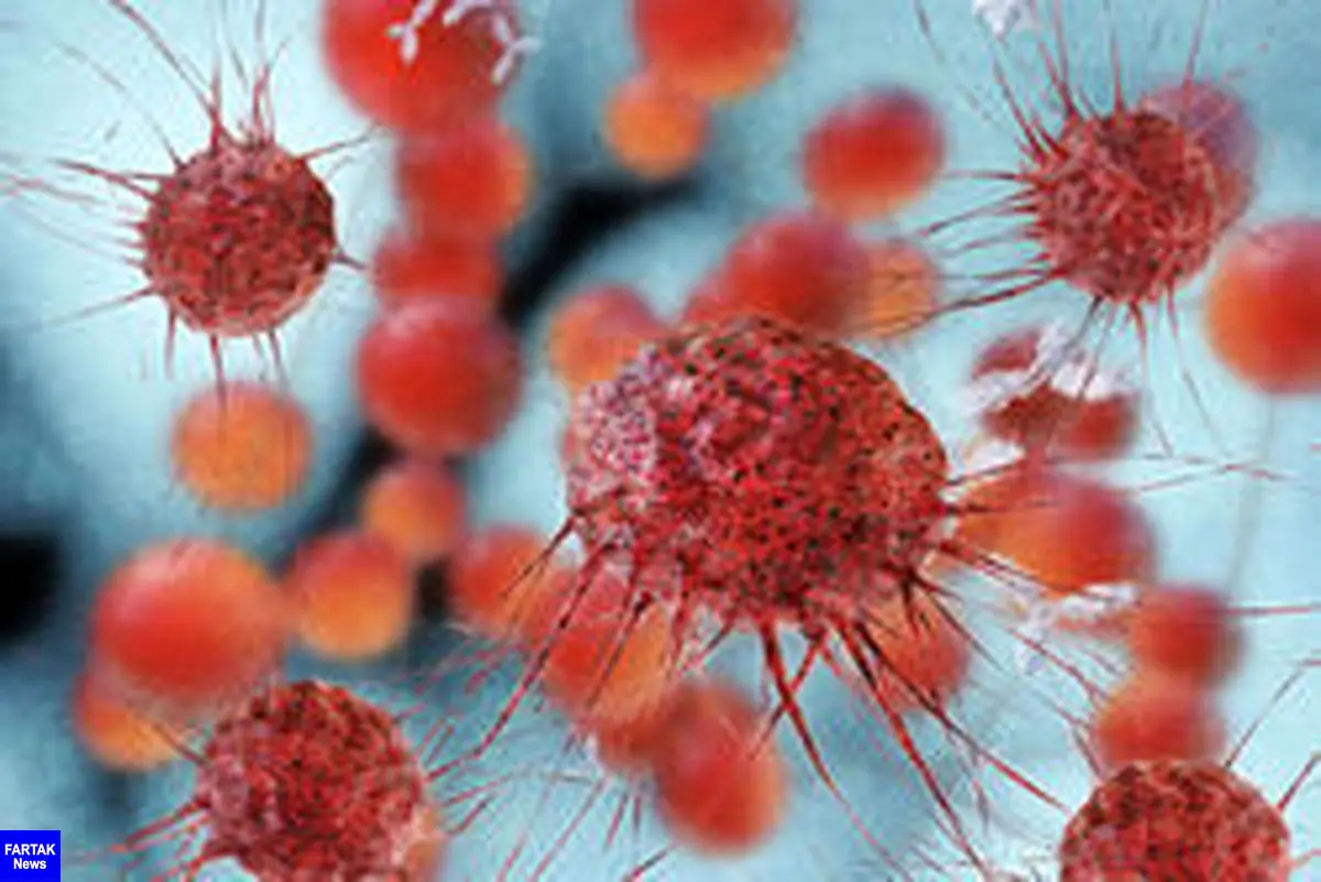 نشانه های ابتلا به سرطان روده بزرگ