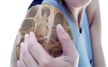 برای پیشگیری از پوکی استخوان این غذاها را بخورید