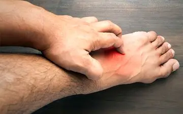 اگزما را در خانه درمان کنید: راهنمای جامع + هشدارهای ضروری